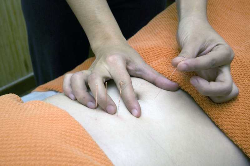 osteopathe-LE CASTELLET-min_acupuncture-4175625